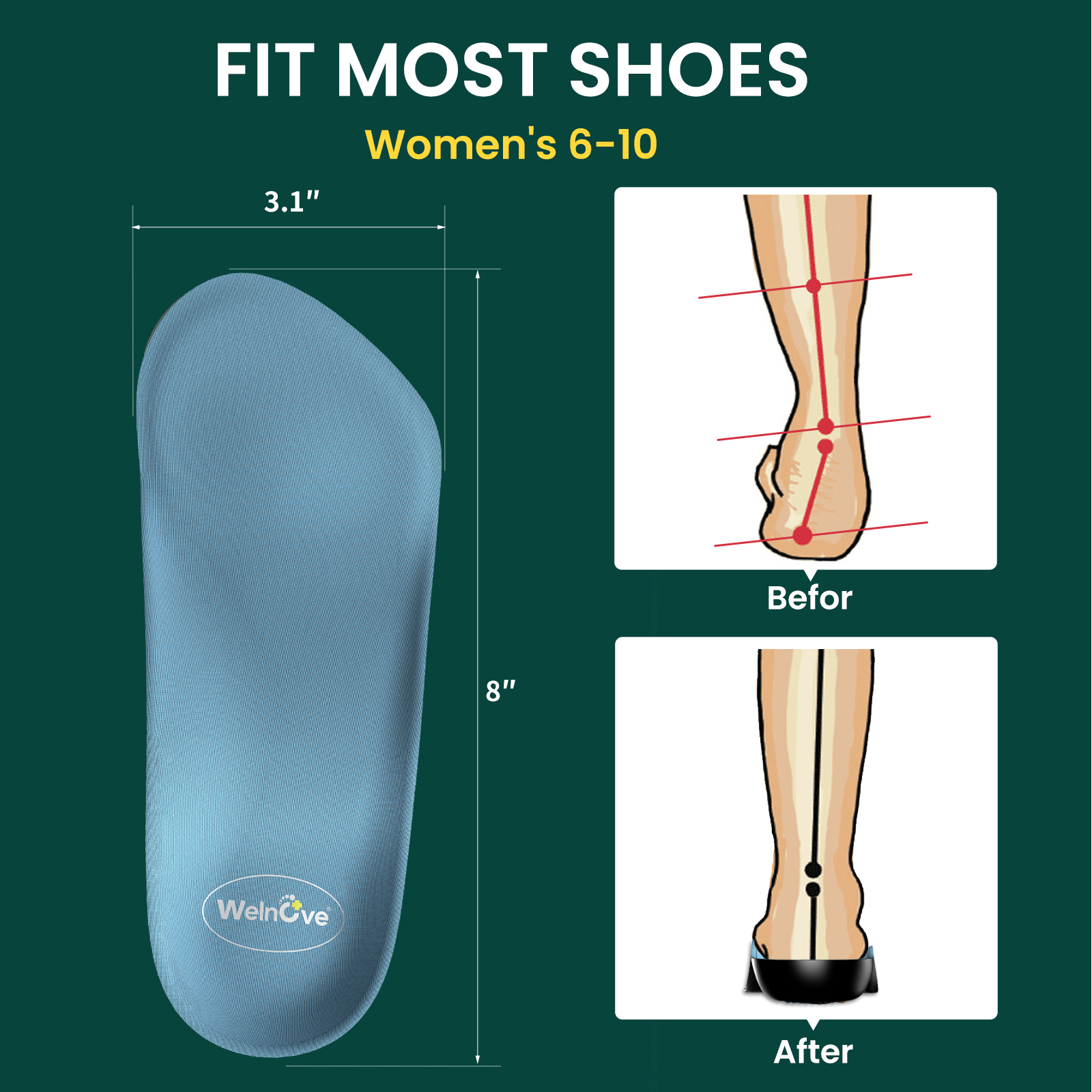 2pcs Female Arch Support Pad O - Insole Arch Support บทวิจารณ์และราคา